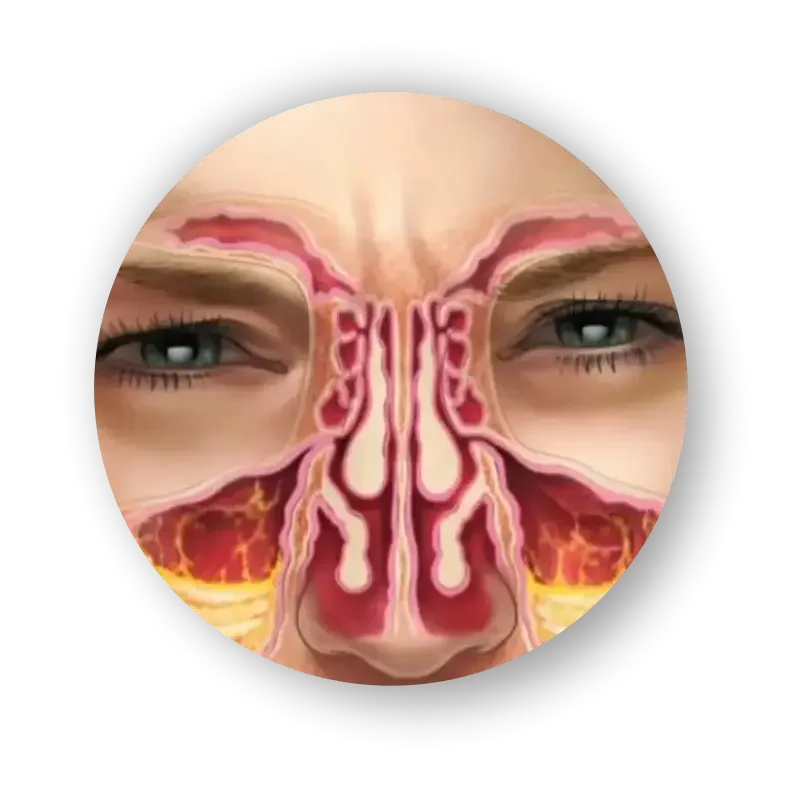 Imagem Sinus Control 3